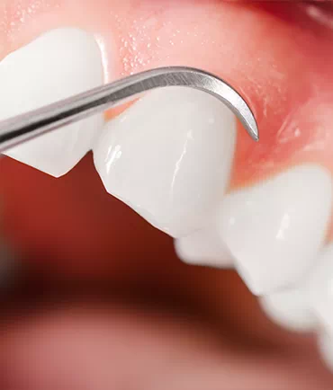 Stomatologia zęby i narzędzie stomatologiczne