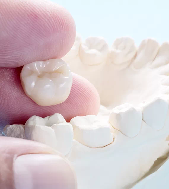 Protetyka makieta zęba w dłoni